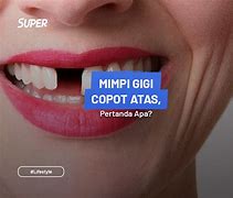 Apa Arti Mimpi Gigi Copot Menurut Primbon Jawa